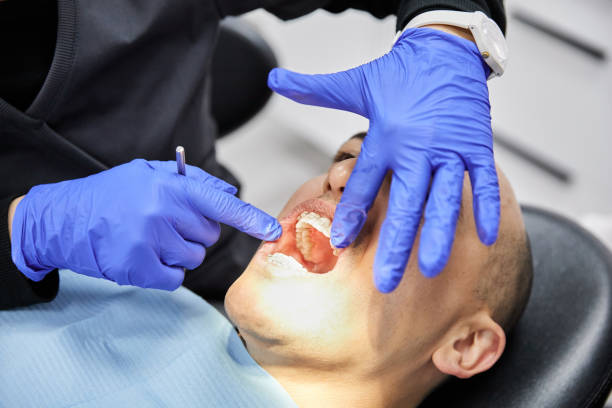 Best Broken or Chipped Tooth Repair in Claypool, AZ